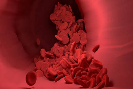 ویروس کرونا جدید می‌تواند باعث ایجاد لخته های خون در بیماران بحرانی شود