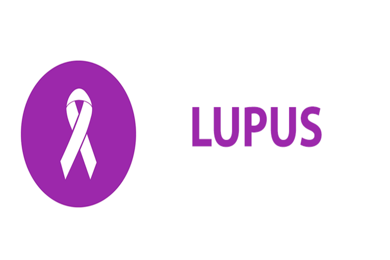 هر آنچه که باید در مورد بیماری لوپوس، این بیماری شایع در خانم ها بدانید!