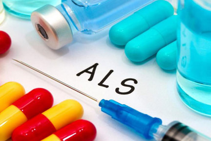 بیماری ALS چیست؟