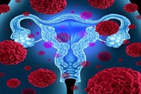 برداشتن تخمدان خطر بیماری پارکینسون را در زنان افزایش می دهد