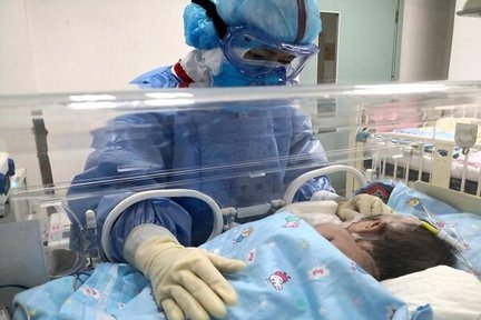 افزایش طول بیماران CF در ایران