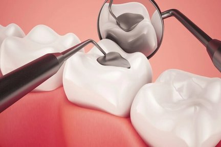 تولید مایعی که از پوسیدگی دندان جلوگیری می‌کند
