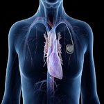 طراحی ضربان‌ساز قلبی که تا ۳۰۰ سال در بدن کار می‌کند!