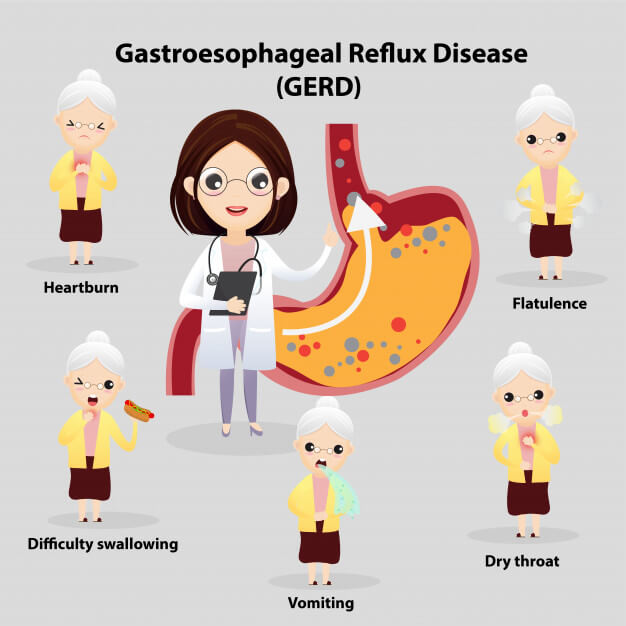 Gastroesophageal-Reflux-Disease - رفلاکس اسید معده به مری