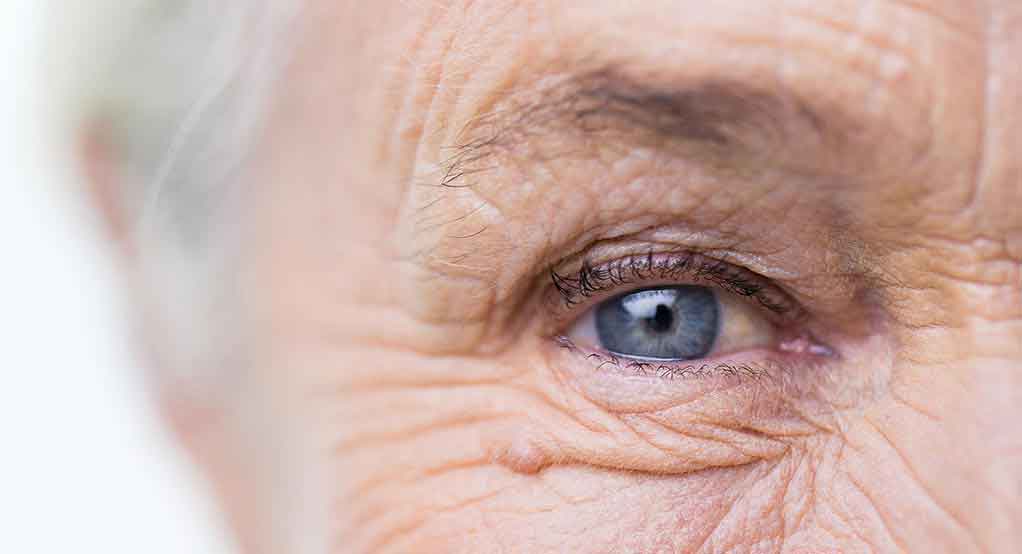 پیر چشمی چیست؟