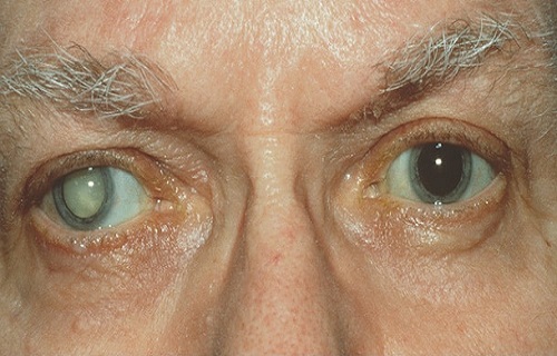 چشم ها در مورد سلامتی شما چه می گویند؟