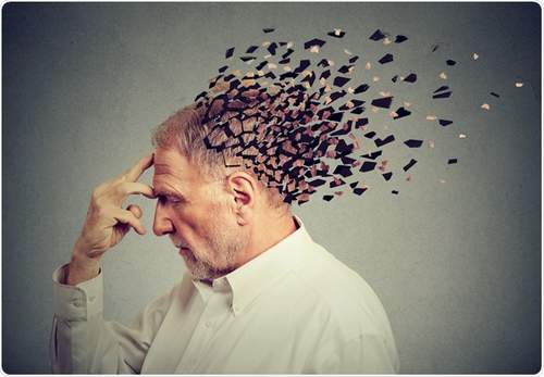  از دست رفتن حافظه و رفتار در آلزایمر