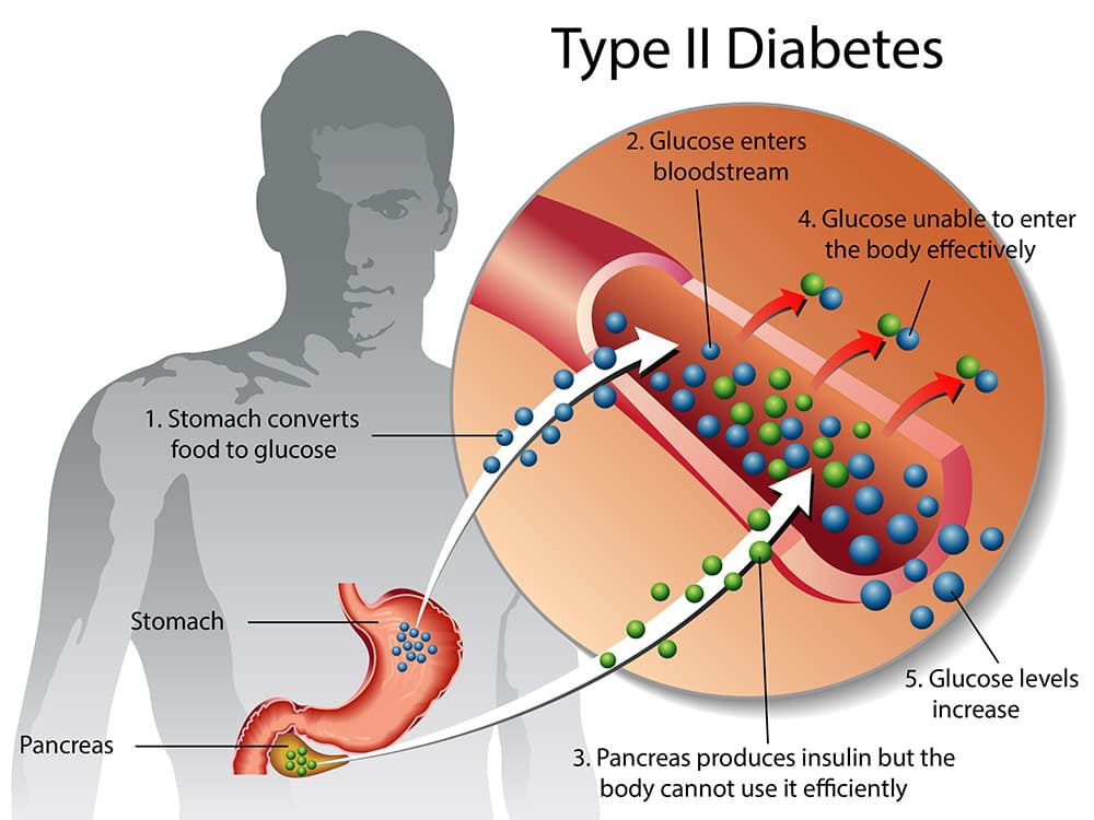 روش عجیب دانشمندان برای درمان دیابت: خوابیدن در شرایط کم‌اکسیژن 