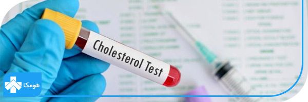 cholesterol در آزمایش خون